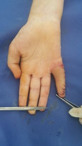 11986439_1007840645905095_4506807419410852867_n