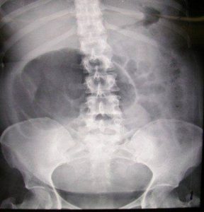 16507199_10207890083001594_1350188590_n